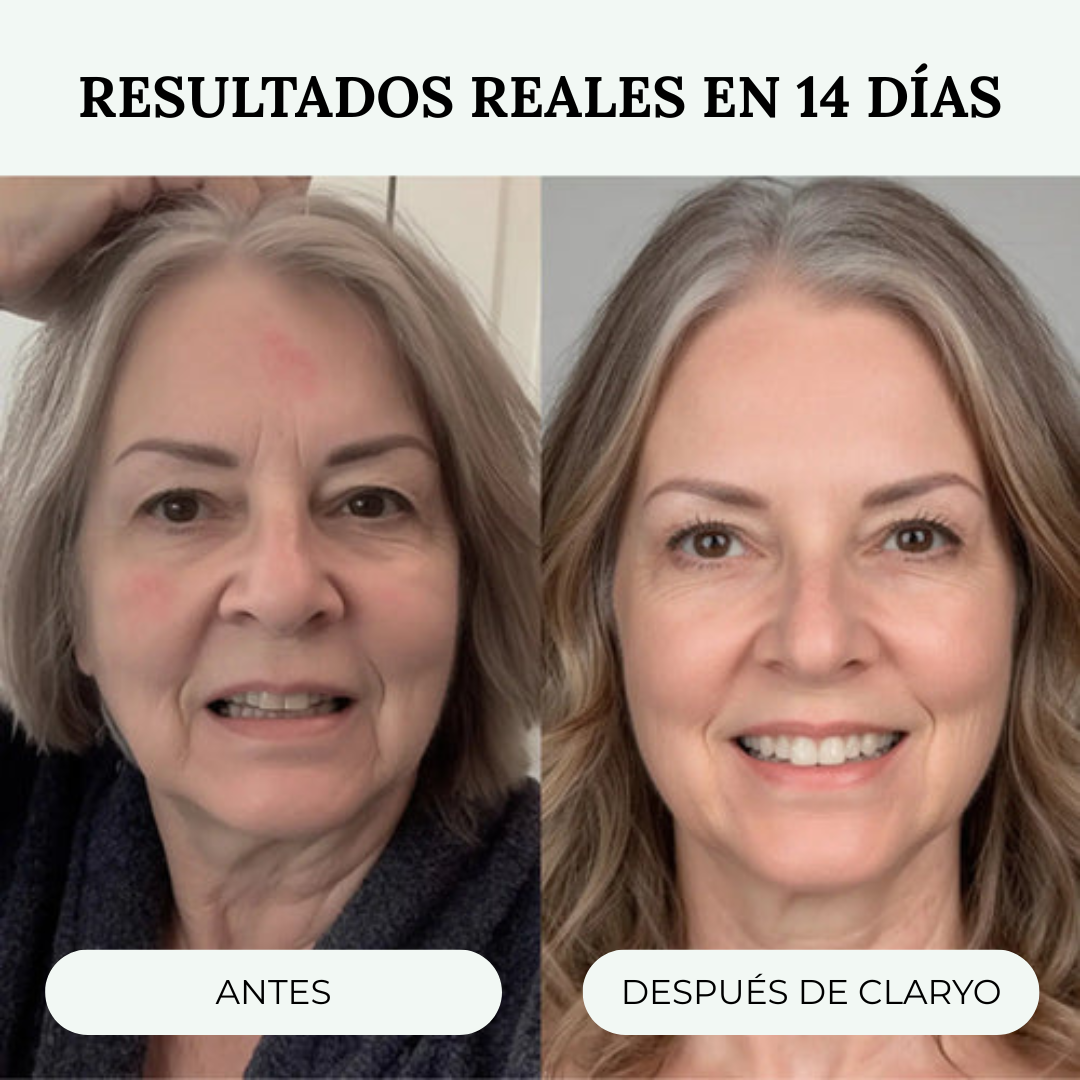Regadera Con Filtro